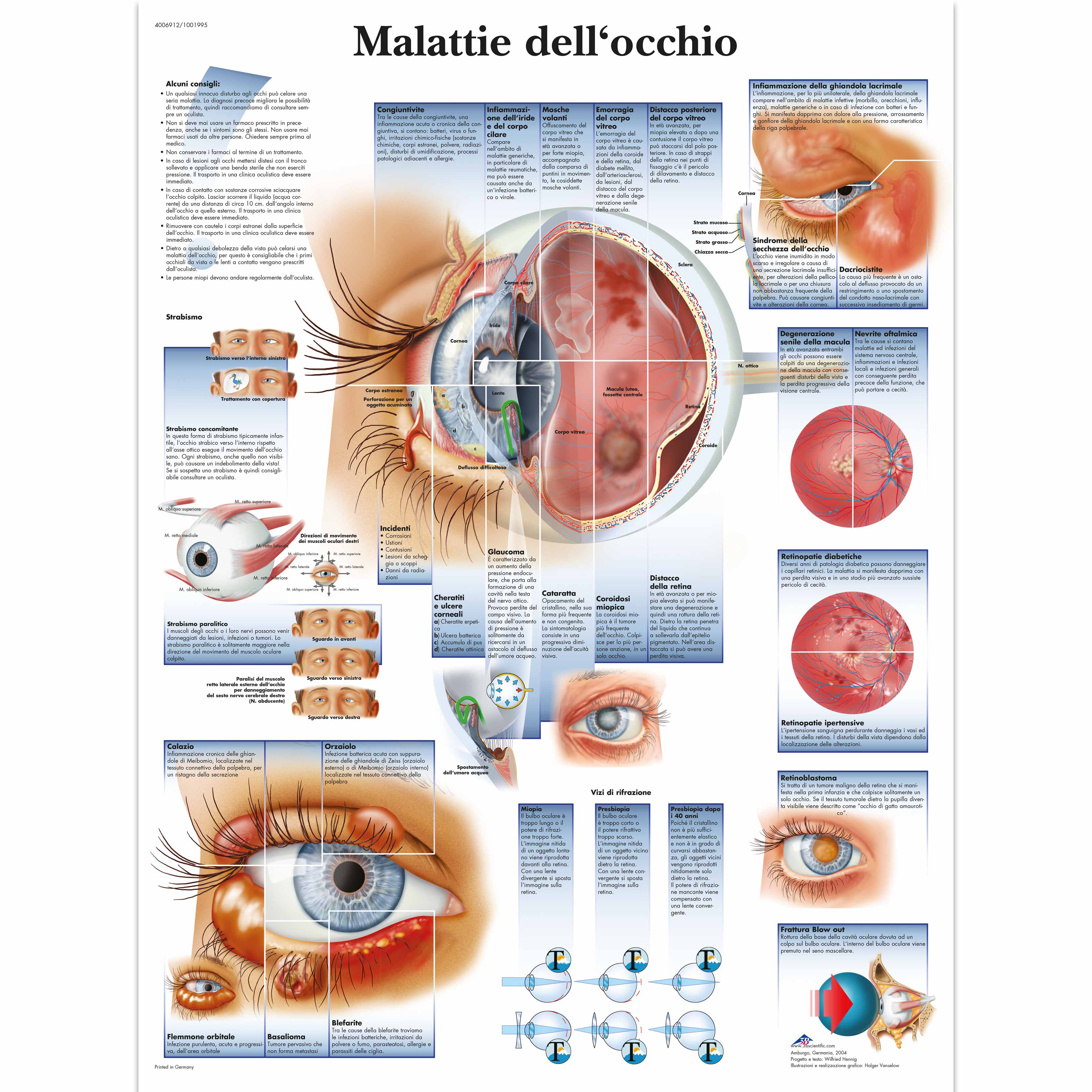 Malattie dell'occhio - 4006912 - VR4231UU - Yeux - 3B Scientific